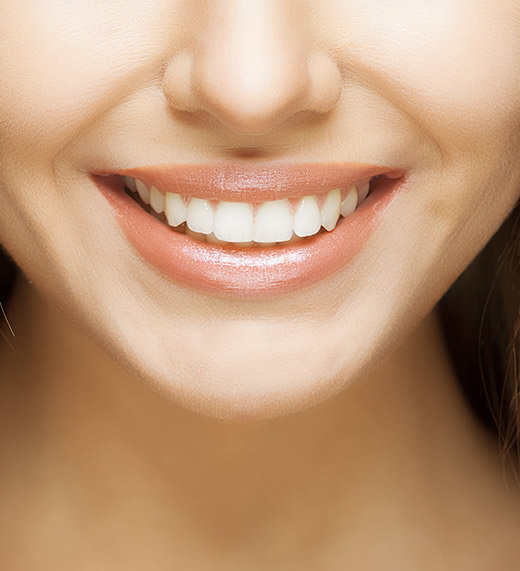 Best Dental Implants in Winter park